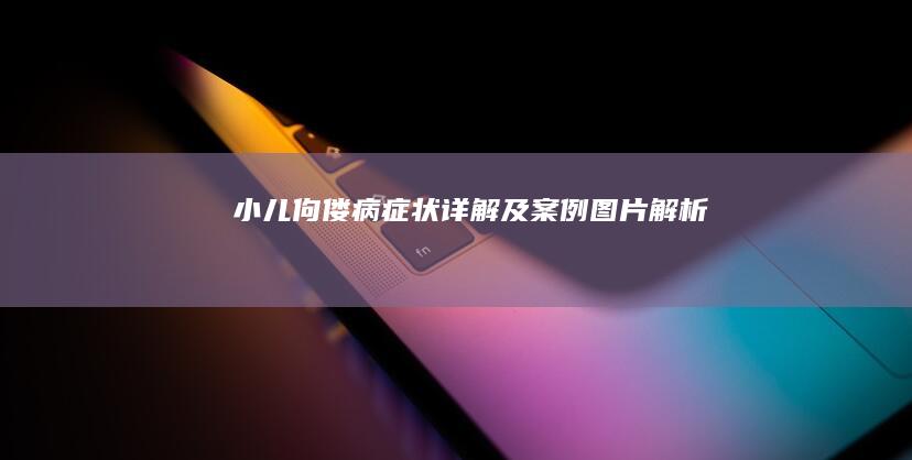 小儿佝偻病症状详解及案例图片解析